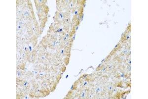 Immunohistochemistry of paraffin-embedded Mouse heart using COX6B1 Polyclonal Antibody at dilution of 1:100 (40x lens). (COX6B1 anticorps)
