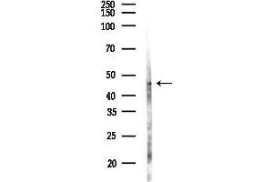 Western blot analysis of lysates from EC304 cells(UV,30 min treatment), using BRE Antibody at 1/1000 dilution.