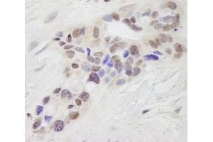 Immunohistochemistry (IHC) image for anti-Signal Transducer and Activator of Transcription 6, Interleukin-4 Induced (STAT6) (AA 600-650) antibody (ABIN7448818)
