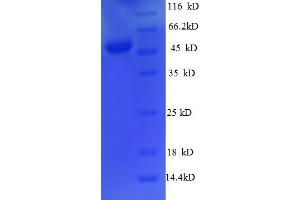 SDS-PAGE (SDS) image for Orthodenticle Homeobox 2 (OTX2) (AA 1-297), (Isoform 2) protein (His-SUMO Tag) (ABIN5710055)