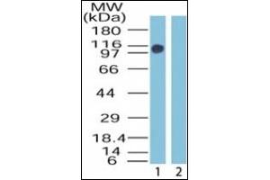 Image no. 2 for anti-Zinc Finger, MYM-Type 2 (ZMYM2) (AA 1250-1300) antibody (ABIN372247)