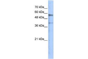 WB Suggested Anti-KREMEN1 Antibody Titration: 0. (KREMEN1 anticorps  (N-Term))