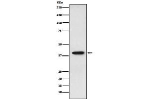 Western blot analysis of SET expression in HepG2 cell lysate.