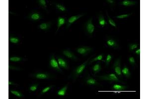 Immunofluorescence of monoclonal antibody to OLIG1 on HeLa cell. (OLIG1 anticorps  (AA 80-159))