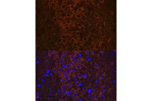 Immunofluorescence analysis of rat brain using Phospho-Tau-T231 antibody (ABIN7268531). (MAPT anticorps  (pThr231))