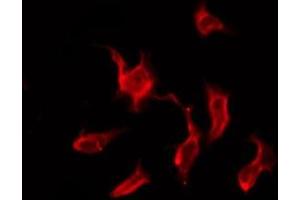 ABIN6276195 staining HeLa by IF/ICC. (OR9G4 anticorps  (C-Term))