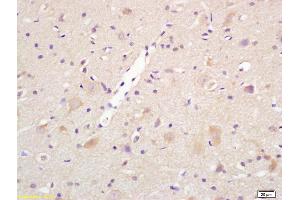 Formalin-fixed and paraffin embedded rat brain labeled with Rabbit Anti Centaurin alpha 1 Polyclonal Antibody, Unconjugated (ABIN1386169) at 1:200 followed by conjugation to the secondary antibody and DAB staining (ADAP1 anticorps  (AA 101-200))