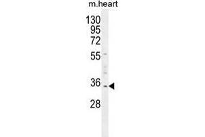 UPP2 Antibody (C-term) western blot analysis in mouse heart tissue lysates (35 µg/lane). (UPP2 anticorps  (C-Term))