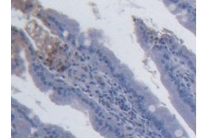 DAB staining on IHC-P; Samples: Rat Small intestine Tissue (IL-15 anticorps  (AA 49-162))