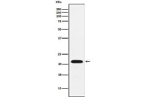 Western blot analysis of CBFb expression in K562 cell lysate.