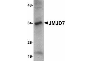 Image no. 1 for anti-Jumonji Domain Containing 7 (JMJD7) (C-Term) antibody (ABIN478159)