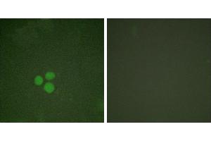 Forskolin + -Immunofluorescence analysis of HeLa cells, treated with Forskolin (40nM, 30mins), using DP-1 antibody.