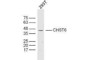 293T lysates probed with CHST6 Polyclonal Antibody, Unconjugated  at 1:300 dilution and 4˚C overnight incubation. (CHST6 anticorps  (AA 101-200))