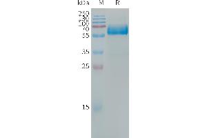 Human LOX-1 Protein, hFc Tag on SDS-PAGE under reducing condition.