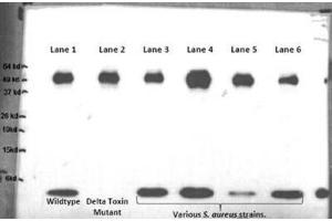 anti-delta Hemolysin antibody