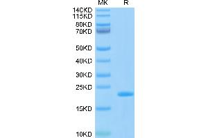 SARS-CoV-2 Nucleocapsid (SARS-CoV-2 N) (AA 243-364) protein (His-Avi Tag,Biotin)
