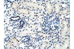 Image no. 1 for anti-DEAD (Asp-Glu-Ala-Asp) Box Polypeptide 17 (DDX17) (AA 570-619) antibody (ABIN203205)