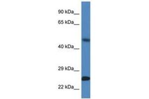 Image no. 1 for anti-Sorting Nexin 10 (SNX10) (AA 100-149) antibody (ABIN6747387) (SNX10 anticorps  (AA 100-149))