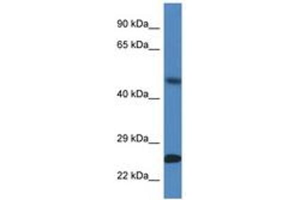SNX10 anticorps  (AA 100-149)