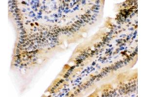IHC analysis of NIRF using anti-NIRF antibody (ABIN3044559).