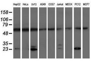 Image no. 2 for anti-Proteasome (Prosome, Macropain) Subunit, beta Type, 9 (Large Multifunctional Peptidase 2) (PSMB9) (AA 21-219) antibody (ABIN1491192)