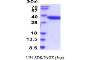 Acid Phosphatase 5, Tartrate Resistant (ACP5) (AA 22-325) (Active) protein (His tag)