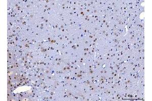 IHC analysis of HnRNP H/HNRNPH1 using anti-HnRNP H/HNRNPH1 antibody (ABIN4886623). (HNRNPH1 anticorps  (N-Term))