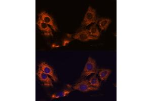 Immunofluorescence analysis of C6 cells using SM antibody (ABIN7270612) at dilution of 1:100.
