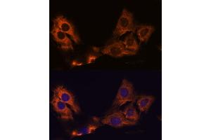 Immunofluorescence analysis of C6 cells using SM antibody (ABIN7270612) at dilution of 1:100. (SMAP1 anticorps  (AA 180-250))