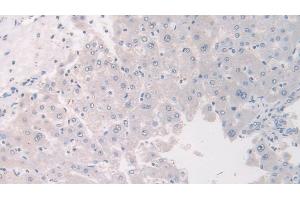 Detection of FLII in Human Liver Tissue using Polyclonal Antibody to Flightless I Homolog (FLII)