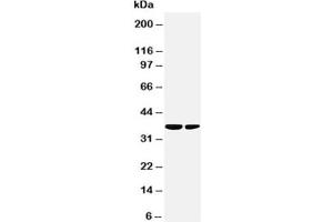 Western blot testing of PP2Ac antibody and Lane 1:  rat kidney (Microtubule Star anticorps  (N-Term))