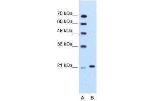 WB Suggested Anti-TRIM26  Antibody Titration: 1. (TRIM26 anticorps  (N-Term))