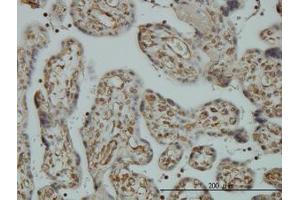 Image no. 1 for anti-Non-SMC Condensin I Complex, Subunit D2 (NCAPD2) (AA 1240-1339) antibody (ABIN599100) (NCAPD2 anticorps  (AA 1240-1339))