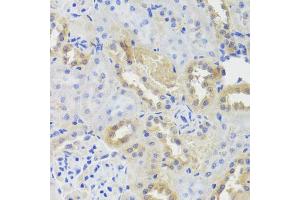 Immunohistochemistry of paraffin-embedded rat kidney using CTSC antibody (ABIN5974676) at dilution of 1/100 (40x lens). (CTSC anticorps)