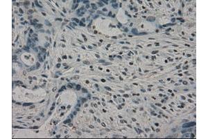 Image no. 5 for anti-Crystallin, alpha B (CRYAB) antibody (ABIN1497645) (CRYAB anticorps)