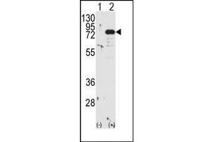 Western blot analysis of PRKCB (arrow) using PKC beta1/2 Antibody (PKC beta anticorps  (C-Term))