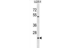 Western Blotting (WB) image for anti-UL16 Binding Protein 2 (ULBP2) antibody (ABIN2999200) (ULBP2 anticorps)