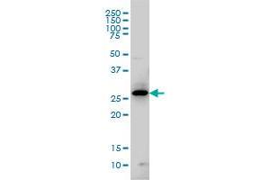 GCH1 monoclonal antibody (M01), clone 4A12 Western Blot analysis of GCH1 expression in IMR-32 .