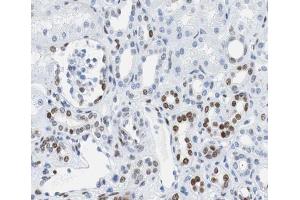ABIN6267317 at 1/200 staining human kidney tissue sections by IHC-P.