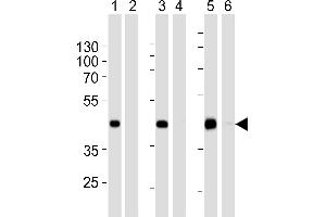 Western blot analysis of extracts from 293 (lanes 1 and 2),HepG2 (lanes 3 and 4)cell line and mouse spleen (lanes 5 and 6)tissue lysate: 1, 3, 5. (STEAP2 anticorps  (AA 229-258))