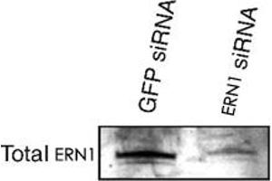 Western blot analysis of ERN1 alpha in transfected min6 cells using ERN1 polyclonal antibody . (ERN1 anticorps  (AA 700-800))