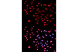 Immunofluorescence analysis of U2OS cell using CDK9 antibody. (CDK9 anticorps  (AA 153-372))