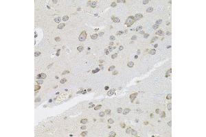 Immunohistochemistry of paraffin-embedded mouse brain using VEPH1 antibody (ABIN5974616) (40x lens). (VEPH1 anticorps)