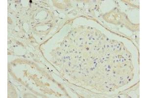 Immunohistochemistry of paraffin-embedded human kidney tissue using ABIN7155892 at dilution of 1:100 (HGD anticorps  (AA 226-445))