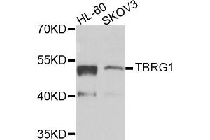 Western blot analysis of extracts of various cell lines, using TBRG1 antibody (ABIN5975095) at 1/1000 dilution.
