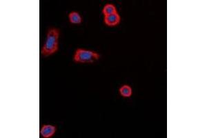 Immunofluorescent analysis of MC5 Receptor staining in MCF7 cells. (MC5 Receptor anticorps  (C-Term))
