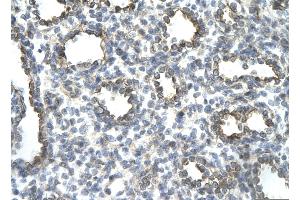 Rabbit Anti-JUN Antibody       Paraffin Embedded Tissue:  Human alveolar cell   Cellular Data:  Epithelial cells of renal tubule  Antibody Concentration:   4. (C-JUN anticorps  (N-Term))