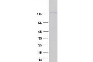 Validation with Western Blot