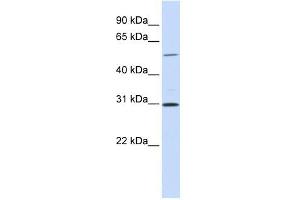 NEK3 antibody used at 1 ug/ml to detect target protein. (NEK3 anticorps)
