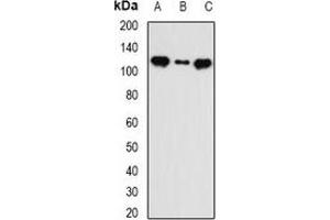 Western blot analysis of INTS5 expression in MCF7 (A), HT29 (B), mouse liver (C) whole cell lysates. (INTS5 anticorps)
